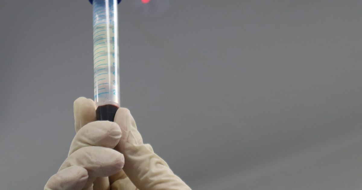 How to prepare for the «Hematocrit» test: rules for taking it
