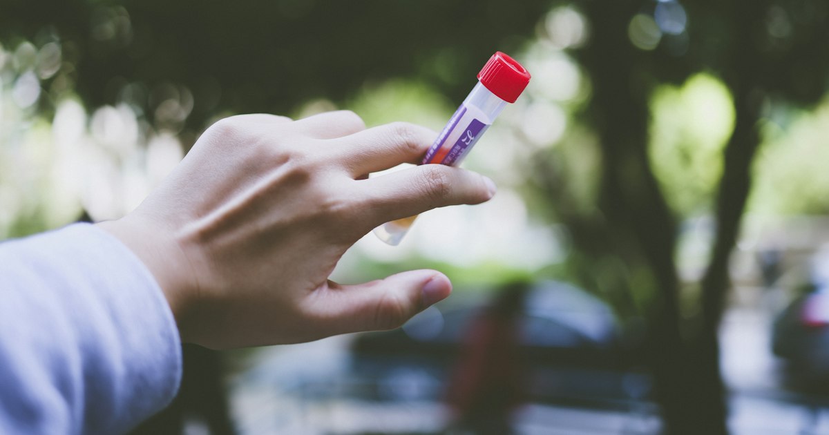 How to prepare for the «Creatinine» test: rules for taking it