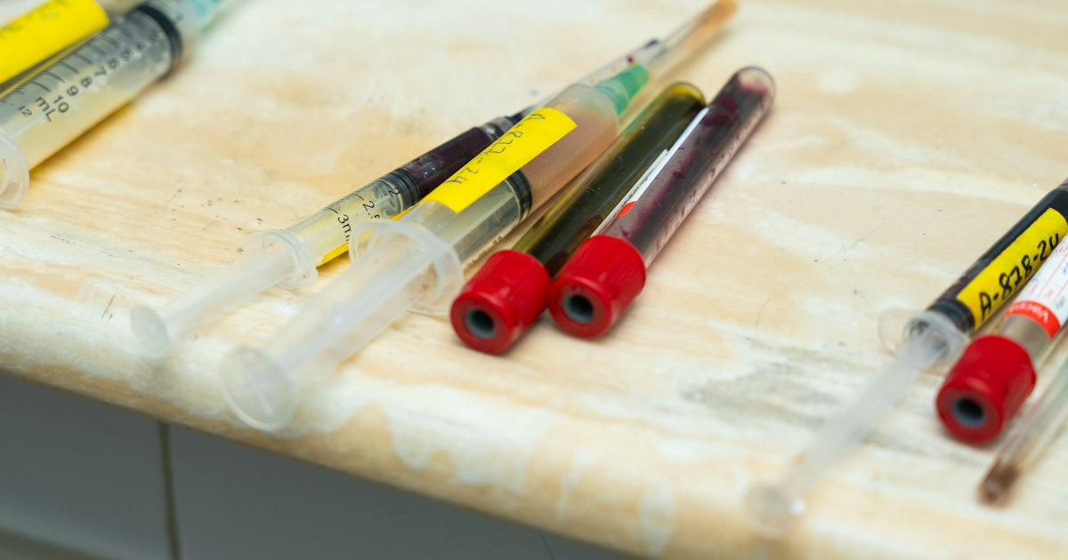 How to prepare for the «Cystatin C» test: rules for taking it